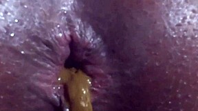 Atriix27 Enema: Hardcore Anal Tease