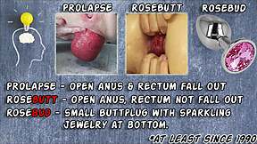 Hotkinkyjo In A See-Through Open-Crotch Swimsuit Self Anal Fisting & Prolapse Tits Bikini Ass Boobs Public Big Tits Asshole Fisting