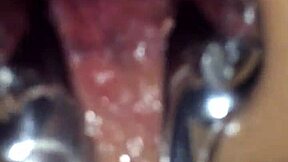 Shemale Used Speculum On Me For Anal Assfucking