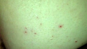 Monster black cock pounds fat white ass cheeks deep and relentless