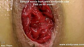 mrplay fists sindy rose's ass on kitchen table prolapse