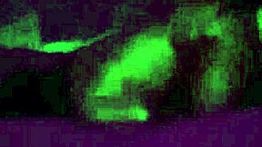 Brazilian Wife Gapes Ass on Hubby's Monster Cock Head